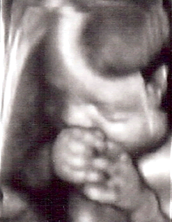 In-office 4D ultrasound