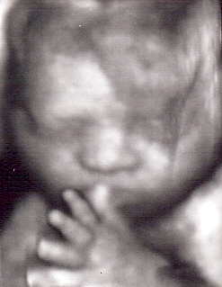 In-office 4D ultrasound